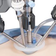 Single-Site-Surgery…-Performing-Complex-Surgery-Through-a-1-inch-Incision_