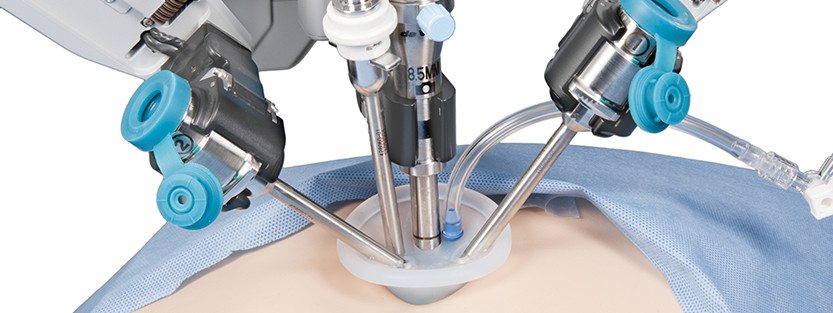 Robotic surgical arm performing minimally invasive procedure.