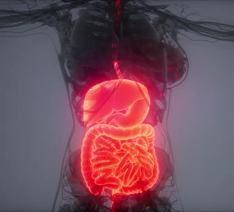 hernia procedure img