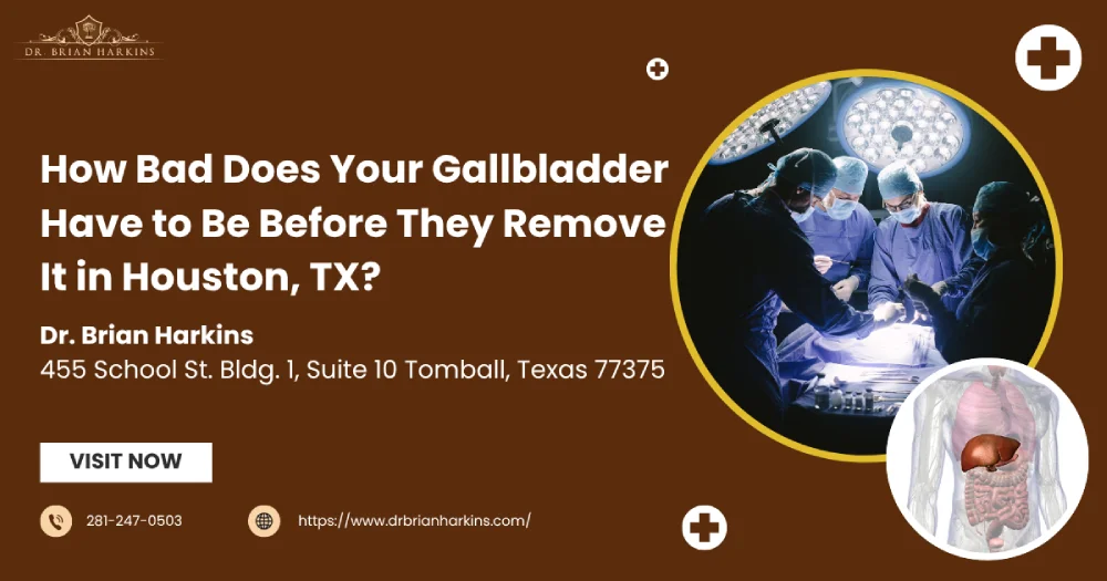 How Bad Does Your Gallbladder Have to Be Before They Remove It in Houston, TX?