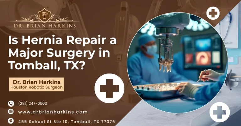 Is Hernia Repair a Major Surgery in Tomball, TX?