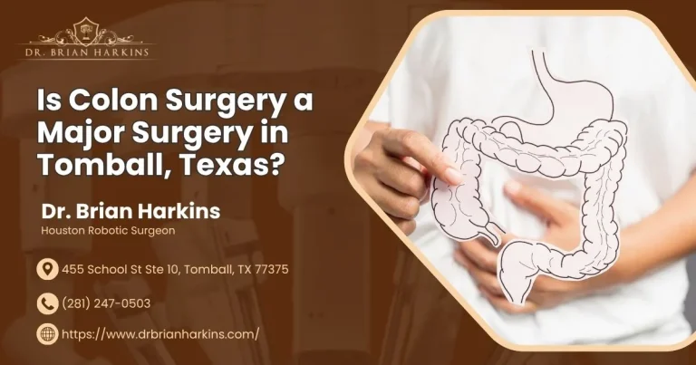 is colon surgery a major surgery in tomball, texas