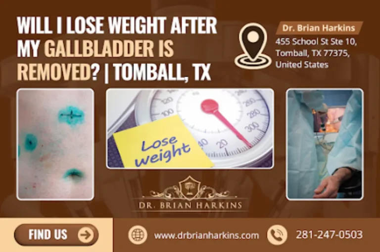 will i lose weight after my gallbladder is removed tomball, tx
